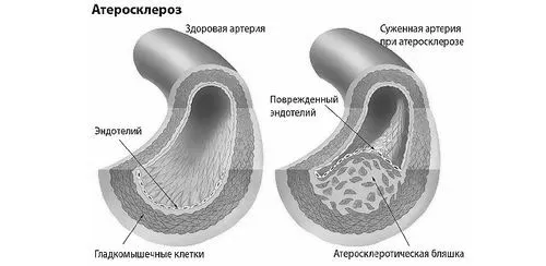 головного