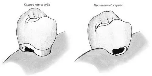 лікувати