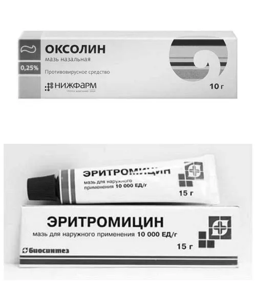 стоматит