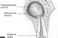 верхньої