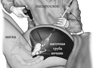причини