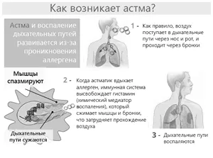 Кашлевая астма - що може ховатися за хронічним кашлем кашлевая