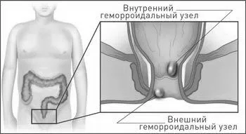 методи