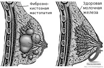 лікування