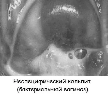 причини