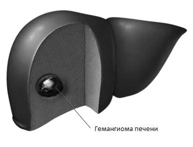 лікування