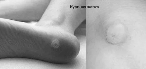 як лікувати