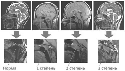 дорослих