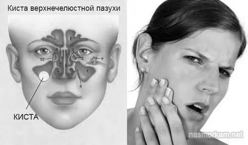 причини