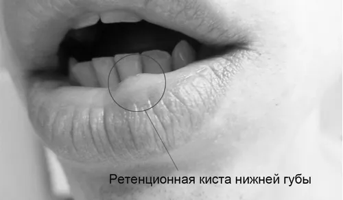 губі