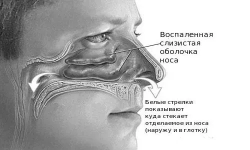 прополісом