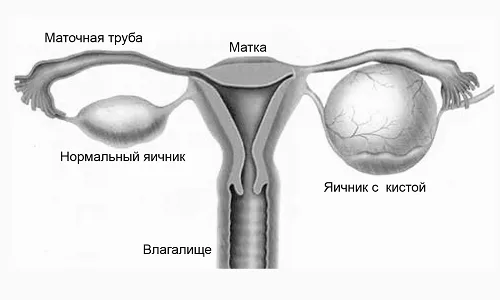 захворювання