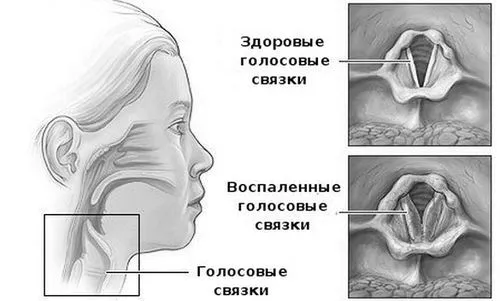 кашель