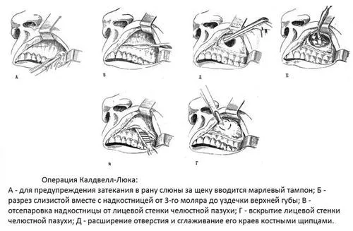 лікування