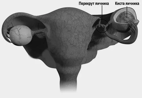 симптоми