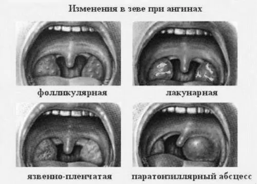 лікування
