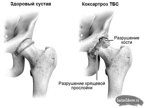 ступеня