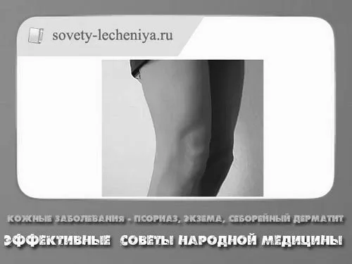 шкірні