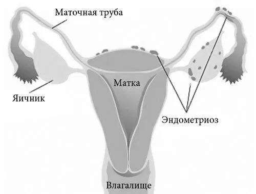 лікування