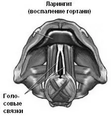 гострій
