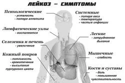 лікування