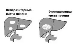 засобами