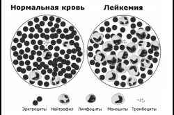 органи кровотворення