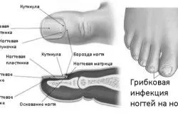 оцтом