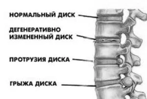 лікування
