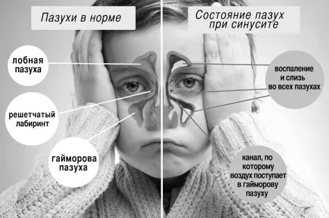 ознаки