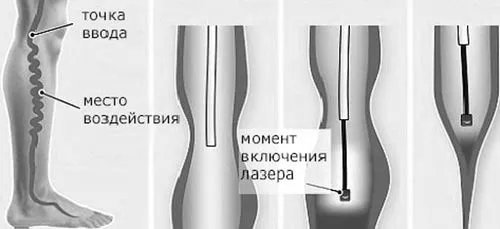 лікування
