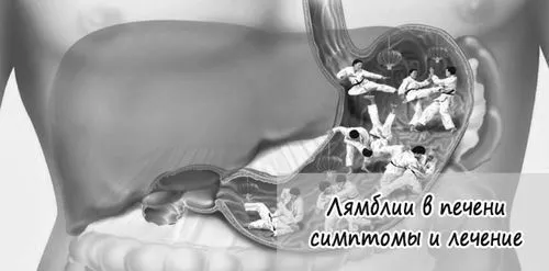 лямблії