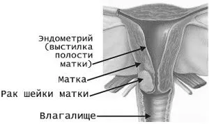 лікування