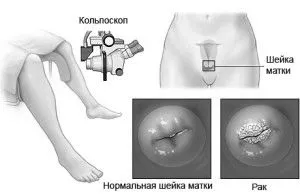 лікування