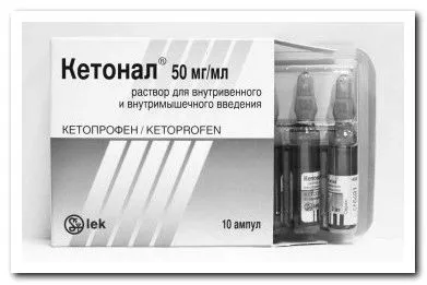 радикуліту