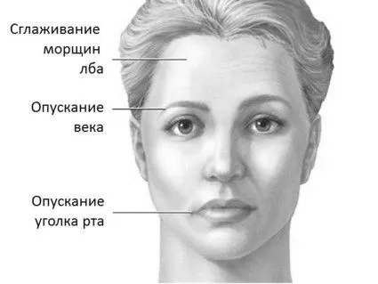 як лікувати невралгію особи