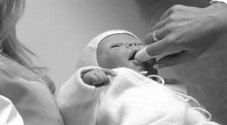як лікувати стоматит мамі
