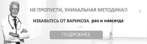 Настоянка каланхое при варикозі: рецепт при варикозному розширенні вен каланхое