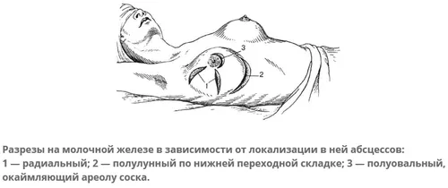 симптоми