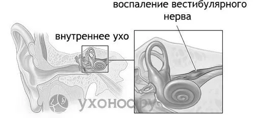 як лікувати вушні нерви