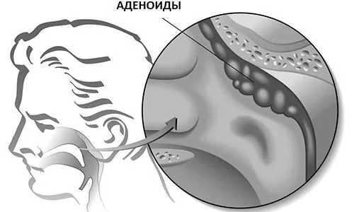 гланди