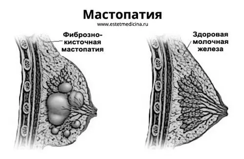 лікування