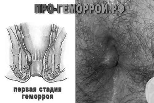 початкова