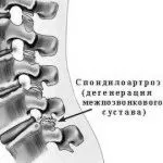 захворювань