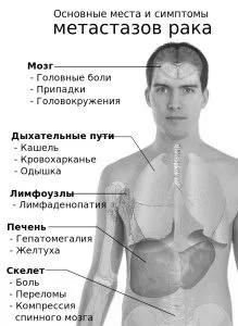 лікування