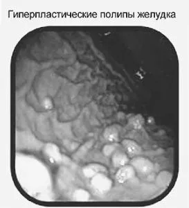 лікування
