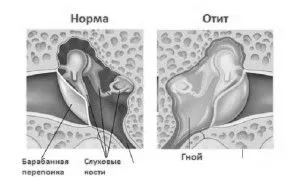 симптоми