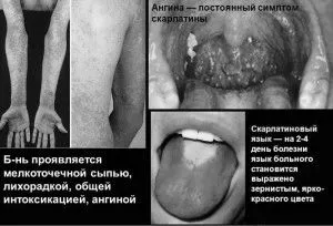 суглоби