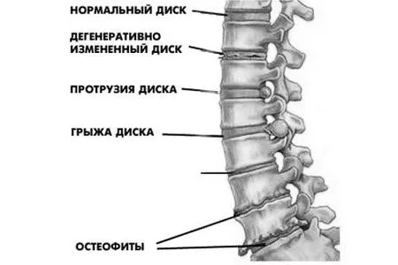 лікування