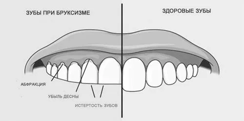 почервоніння